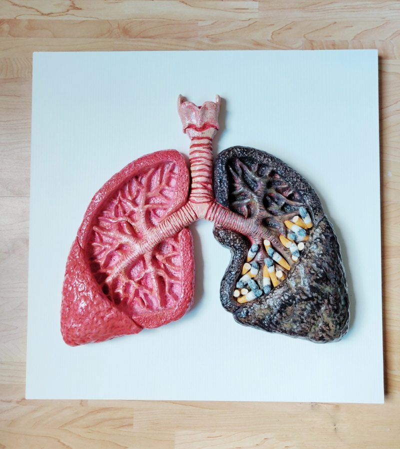Smoker's lungs